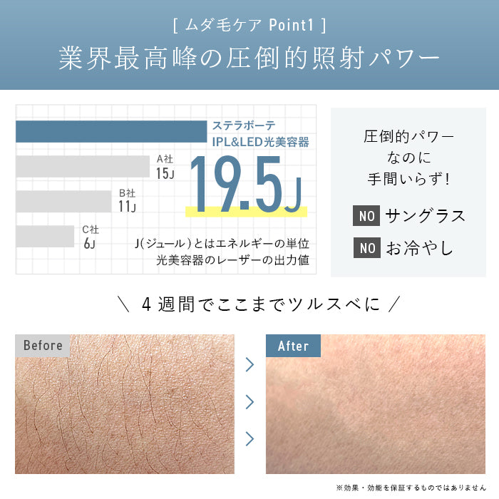 2024年Newモデル》STELLA BEAUTE IPL&LED光美容器（ステラ ボーテ）