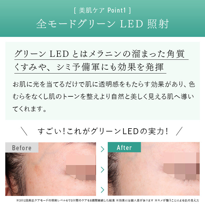 2024年Newモデル》STELLA BEAUTE IPL&LED光美容器（ステラ ボーテ）